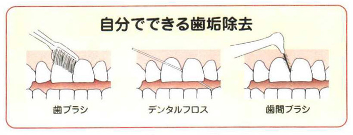 柏森歯科クリニック自分でできる歯垢除去 歯ブラシ デンタルフロス 歯間ブラシ